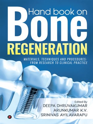 cover image of Hand Book On Bone Regeneration